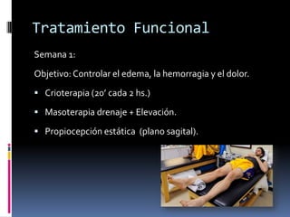 Esguince de Tobillo
Tratamiento Funcional:
 Evita las complicaciones de la cirugía.
 Provoca menor atrofia muscular.
 Se recupera la movilidad articular completa en
forma más temprana.
 Se logra el retorno a la actividad deportiva en
forma más temprana.
 Similares resultados finales que la cirugía.
 