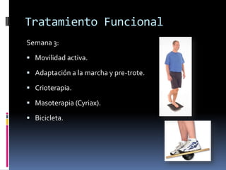 Ejemplo Práctico
Esguince lateral de tobillo Grado II-III.
• Movilidad controlada durante 6 semanas
(Vendaje adhesivo + Brace).
• Finalizadas las 6 semanas, se retira el vendaje y
se completa la etapa de retorno deportivo.
 