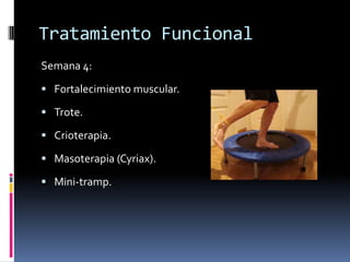 Tratamiento Funcional
Semana 1:
Objetivo: Controlar el edema, la hemorragia y el
dolor.
 Crioterapia (20’ cada 2 hs.)
 Masoterapia drenaje + Elevación.
 Propiocepción estática (plano sagital).
 