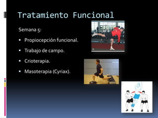 Tratamiento Funcional
Semana 2:
 Movilidad activa.
 Isométricos eversores.
 Propiocepción estática (multiplanar).
 Crioterapia.
 Masoterapia drenaje.
 