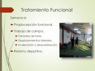 Tratamiento Funcional
Semana 6:
 Propiocepción funcional.
 Trabajo de campo.
 Variantes de trote.
 Desplazamientos laterales.
 Aceleración y desaceleración.
 Retorno deportivo.
 