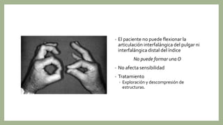 • El paciente no puede flexionar la
articulación interfalángica del pulgar ni
interfalángica distal del índice
No puede formar una O
• No afecta sensibilidad
• Tratamiento
• Exploración y descompresión de
estructuras.
 
