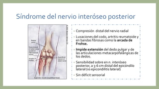 Síndrome del nervio interóseo posterior
• Compresión distal del nervio radial
• Luxaciones del codo, artritis reumatoide y
en bandas fibrosas como la arcada de
Frohse.
• Impide extensión del dedo pulgar y de
las articulaciones metacarpofalángicas de
los dedos.
• Sensibilidad sobre en n. interóseo
posterior, a 3-6 cm distal del epicóndilo
lateral (vs epicondilitis lateral)
• Sin déficit sensorial
 