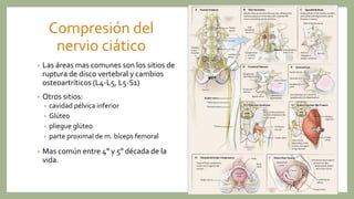 Compresión del
nervio ciático
• Las áreas mas comunes son los sitios de
ruptura de disco vertebral y cambios
osteoartríticos (L4-L5, L5-S1)
• Otros sitios:
• cavidad pélvica inferior
• Glúteo
• pliegue glúteo
• parte proximal de m. bíceps femoral
• Mas común entre 4º y 5º década de la
vida.
 