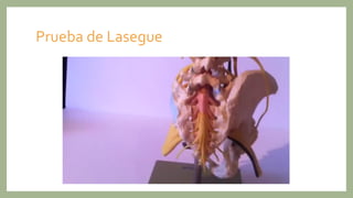Prueba de Lasegue
 