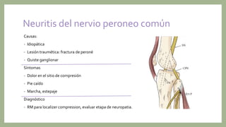 Neuritis del nervio peroneo común
Causas:
• Idiopática
• Lesión traumética: fractura de peroné
• Quiste ganglionar
Síntomas
• Dolor en el sitio de compresión
• Pie caído
• Marcha, estepaje
Diagnóstico
• RM para localizer compression, evaluar etapa de neuropatia.
 