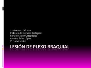 22 de enero del 2014
Instituto de Ciencias Biológicas
Rehabilitación Ortopédica
Alumna Edna López
VI cuatrimestre

LESIÓN DE PLEXO BRAQUIAL

 
