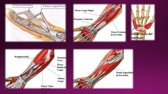 Lesión de tendones flexores y extensores de la mano