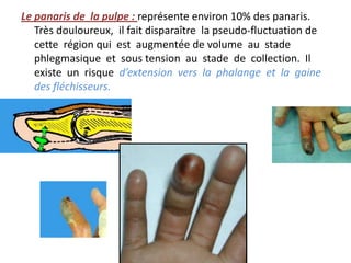 Le panaris de la pulpe : représente environ 10% des panaris.
   Très douloureux, il fait disparaître la pseudo-fluctuation de
   cette région qui est augmentée de volume au stade
   phlegmasique et sous tension au stade de collection. Il
   existe un risque d’extension vers la phalange et la gaine
   des fléchisseurs.
 
