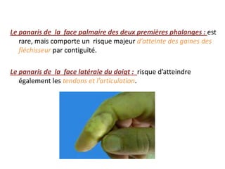 Le panaris de la face palmaire des deux premières phalanges : est
   rare, mais comporte un risque majeur d’atteinte des gaines des
   fléchisseur par contiguïté.

Le panaris de la face latérale du doigt : risque d’atteindre
   également les tendons et l’articulation.
 