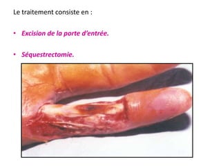 Le traitement consiste en :

• Excision de la porte d’entrée.

• Séquestrectomie.
 