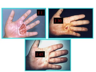 J1
       J 30




J 45
 