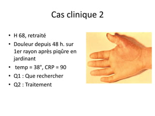 Cas clinique 2

• H 68, retraité
• Douleur depuis 48 h. sur
  1er rayon après piqûre en
  jardinant
• temp = 38°, CRP = 90
• Q1 : Que rechercher
• Q2 : Traitement
 