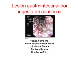 Lesión gastrointestinal por
ingesta de cáusticos
Yesica Camacho
Javier Alejandro Hernández
José Manuel Méndez
Mariana Ramos
Humberto Soto
 