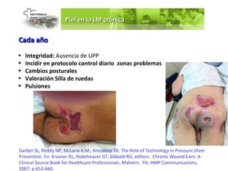 Piel en la LM crónica

Cada año
•   Integridad: Ausencia de UPP
•   Incidir en protocolo control diario zonas problemas
•   Cambios posturales
•   Valoración Silla de ruedas
•   Pulsiones




Garber SL, Reddy NP, McLane K.M., Krouskop TA. The Role of Technology in Pressure Ulcer
Prevention. En: Krasner DL, Rodeheaver GT, Sibbald RG, editors. Chronic Wound Care: A
Clinical Source Book for Healthcare Professionals. Malvern, PA: HMP Communications,
2007: p.653-660.
 