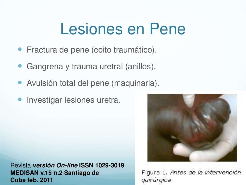 Lesión peneescrototestículo Lesión peneescrototestículo