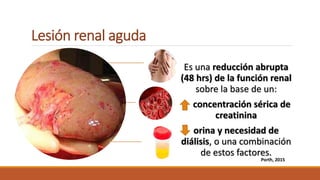 Lesión renal aguda
Es una reducción abrupta
(48 hrs) de la función renal
sobre la base de un:
concentración sérica de
creatinina
orina y necesidad de
diálisis, o una combinación
de estos factores.
Porth, 2015
 