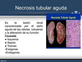 Lesi n Renal Aguda pptx lesi-n-renal-aguda-pptx
