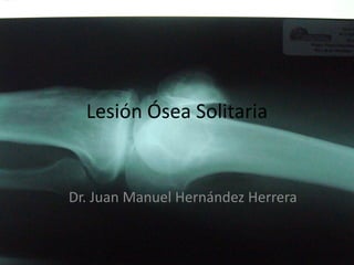 Lesión Ósea Solitaria


Dr. Juan Manuel Hernández Herrera
 