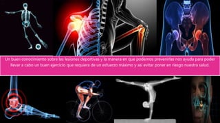 Un buen conocimiento sobre las lesiones deportivas y la manera en que podemos prevenirlas nos ayuda para poder
llevar a cabo un buen ejercicio que requiera de un esfuerzo máximo y así evitar poner en riesgo nuestra salud.
 