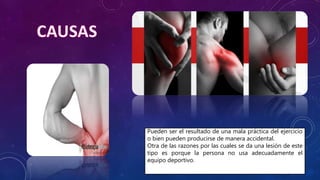 Pueden ser el resultado de una mala práctica del ejercicio
o bien pueden producirse de manera accidental.
Otra de las razones por las cuales se da una lesión de este
tipo es porque la persona no usa adecuadamente el
equipo deportivo.
 
