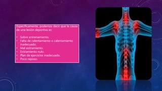 Específicamente, podemos decir que la causa
de una lesión deportiva es:
• Sobre entrenamiento.
• Falta de calentamiento o calentamiento
inadecuado.
• Mal estiramiento.
• Estiramiento nulo.
• Plan de ejercicios inadecuado.
• Poco reposo.
 