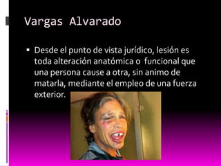 Vargas Alvarado
 Desde el punto de vista jurídico, lesión es
toda alteración anatómica o funcional que
una persona cause a otra, sin animo de
matarla, mediante el empleo de una fuerza
exterior.
 