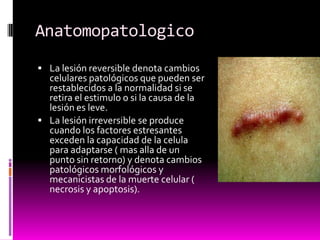 Anatomopatologico
 La lesión reversible denota cambios
celulares patológicos que pueden ser
restablecidos a la normalidad si se
retira el estimulo o si la causa de la
lesión es leve.
 La lesión irreversible se produce
cuando los factores estresantes
exceden la capacidad de la celula
para adaptarse ( mas alla de un
punto sin retorno) y denota cambios
patológicos morfológicos y
mecanicistas de la muerte celular (
necrosis y apoptosis).
 
