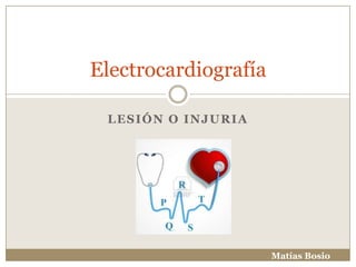 Electrocardiografía
LESIÓN O INJURIA

Matías Bosio

 