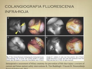 colangiografia fluorescenia
infra-roja
Intraoperative assessment of biliary anatomy for prevention of bile duct injury: a review of
current and future patient safety interventions K. Tim Buddingh • Vincent B. Nieuwenhuijs
 