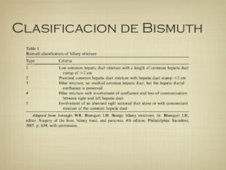 Clasificacion de Bismuth
 
