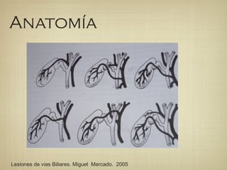 Anatomía
Lesiones de vias Biliares. Miguel Mercado. 2005
 