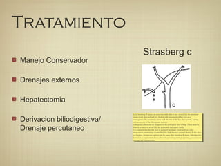 Tratamiento
Manejo Conservador
Drenajes externos
Hepatectomia
Derivacion biliodigestiva/
Drenaje percutaneo
Strasberg c
As in Strasberg B injury, an accessory right duct is sec- tioned but the proximal
stump is not detected and oc- cluded, with an unnoticed bile leak as a
consequence. No continuity exists with the rest of the bile duct system, leaving
endoscopy out of the therapeutic options.
Subhepatic collections are frequent in the postopera- tive setting. These must be
drained in order to avoid bili- ary peritonitis and septic shock.
It is common that the bile leak is occluded spontane- ously with no other
intervention maintaining a controlled bile leak through external drains. If this does
not happen, therapeutic options are the same that Strasberg B injury, biliodigestive
derivation to segmentary ducts (also with poor long term prognosis), percutaneous
drainage and hepatectomy.
As in Strasberg B injury, an accessory right duct is sec- tioned but the proximal
stump is not detected and oc- cluded, with an unnoticed bile leak as a
consequence. No continuity exists with the rest of the bile duct system, leaving
endoscopy out of the therapeutic options.
Subhepatic collections are frequent in the postopera- tive setting. These must be
drained in order to avoid bili- ary peritonitis and septic shock.
It is common that the bile leak is occluded spontane- ously with no other
intervention maintaining a controlled bile leak through external drains. If this does
not happen, therapeutic options are the same that Strasberg B injury, biliodigestive
derivation to segmentary ducts (also with poor long term prognosis), percutaneous
drainage and hepatectomy.
 