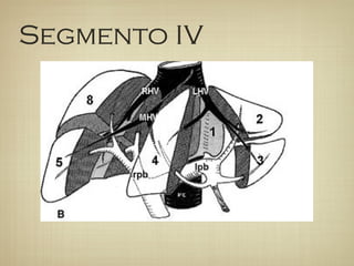 Segmento IV
 