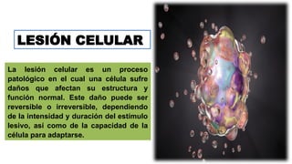 La lesión celular es un proceso
patológico en el cual una célula sufre
daños que afectan su estructura y
función normal. Este daño puede ser
reversible o irreversible, dependiendo
de la intensidad y duración del estímulo
lesivo, así como de la capacidad de la
célula para adaptarse.
LESIÓN CELULAR
 