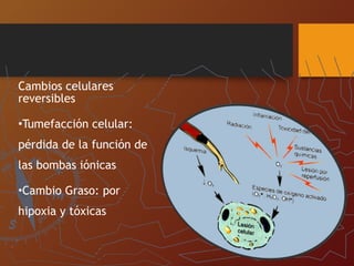 Cambios celulares
reversibles
•Tumefacción celular:
pérdida de la función de
las bombas iónicas
•Cambio Graso: por
hipoxia y tóxicas
 