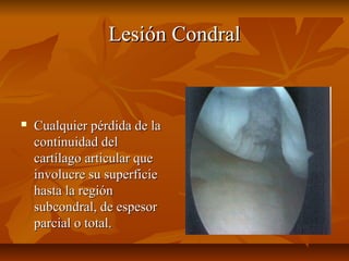 LLeessiióónn CCoonnddrraall 
 CCuuaallqquuiieerr ppéérrddiiddaa ddee llaa 
ccoonnttiinnuuiiddaadd ddeell 
ccaarrttííllaaggoo aarrttiiccuullaarr qquuee 
iinnvvoolluuccrree ssuu ssuuppeerrffiicciiee 
hhaassttaa llaa rreeggiióónn 
ssuubbccoonnddrraall,, ddee eessppeessoorr 
ppaarrcciiaall oo ttoottaall.. 
 