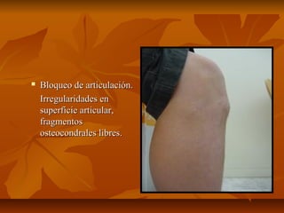  BBllooqquueeoo ddee aarrttiiccuullaacciióónn.. 
IIrrrreegguullaarriiddaaddeess eenn 
ssuuppeerrffiicciiee aarrttiiccuullaarr,, 
ffrraaggmmeennttooss 
oosstteeooccoonnddrraalleess lliibbrreess.. 
 