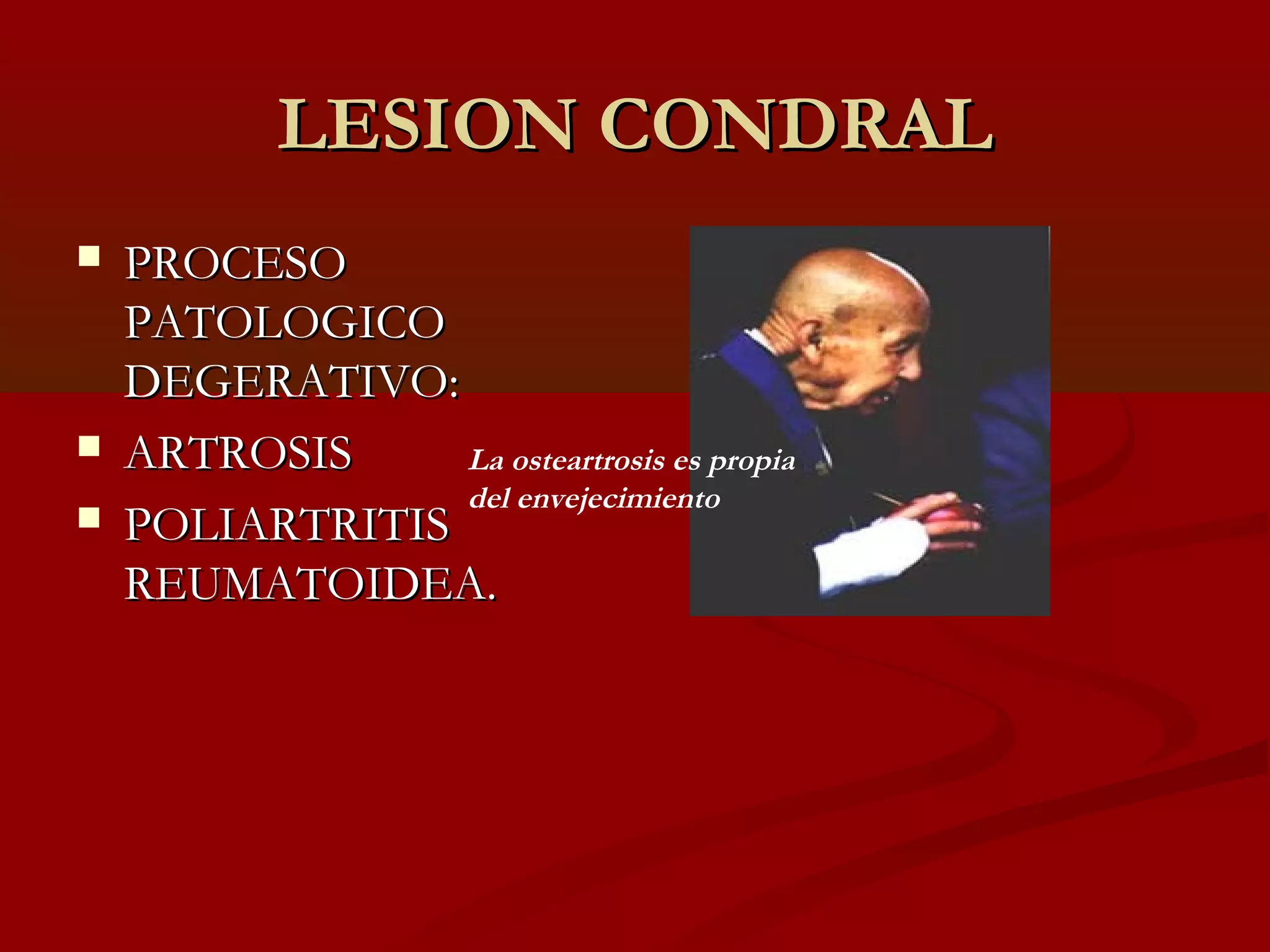 Lesion condral principios y clasificaciones | PPT