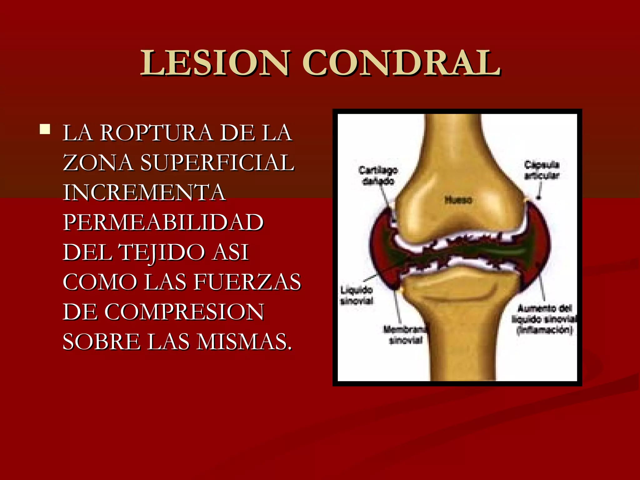 Lesion condral principios y clasificaciones | PPT