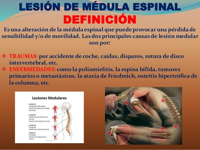 Lesion de medula espinal