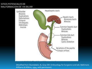 (Modified from Skandalakis JE, Gray SW. Embryology for Surgeons (2nd ed). Baltimore:
Williams & Wilkins, 1994; with permission)
SITIOS POTENCIALES DE
MALFORMACION DE VIA BILIAR
 