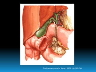 The American Journal of Surgery (2008) 195, 763–769
 