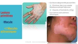 les Lesions elementaires en dermatologie Slide 31