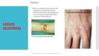 les Lesions elementaires en dermatologie Slide 44