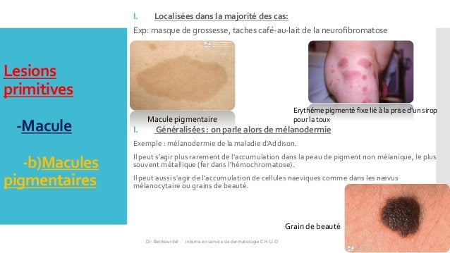 La crème avec arboutinom des taches de pigment acheter