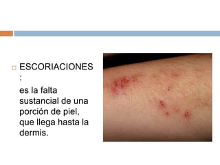 Lesiones | PPTX