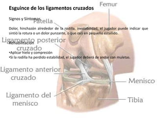 Esguince de los ligamentos cruzados
Signos y Síntomas
Dolor, hinchazón alrededor de la rodilla, inestabilidad, el jugador puede indicar que
sintió la rotura o un dolor punzante, o que oyó en pequeño estallido.

Rehabilitación
•Aplicar hielo y compresión
•Si la rodilla ha perdido estabilidad, el jugador deberá de andar con muletas.

 