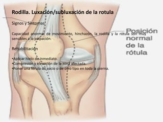Rodilla. Luxación/subluxación de la rotula
Signos y Síntomas
Capacidad anormal de movimiento, hinchazón, la rodilla y la rótula son muy
sensibles a la palpación.

Rehabilitación
•Aplicar hielo de inmediato.
•Compresión y elevación de la zona afectada.
•Poner una férula de vacio o de otro tipo en toda la pierna.

 