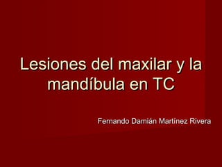 Lesiones del maxilar y la
mandíbula en TC
Fernando Damián Martínez Rivera

 